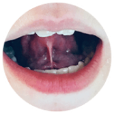 Tongue & Lip Ties Icon