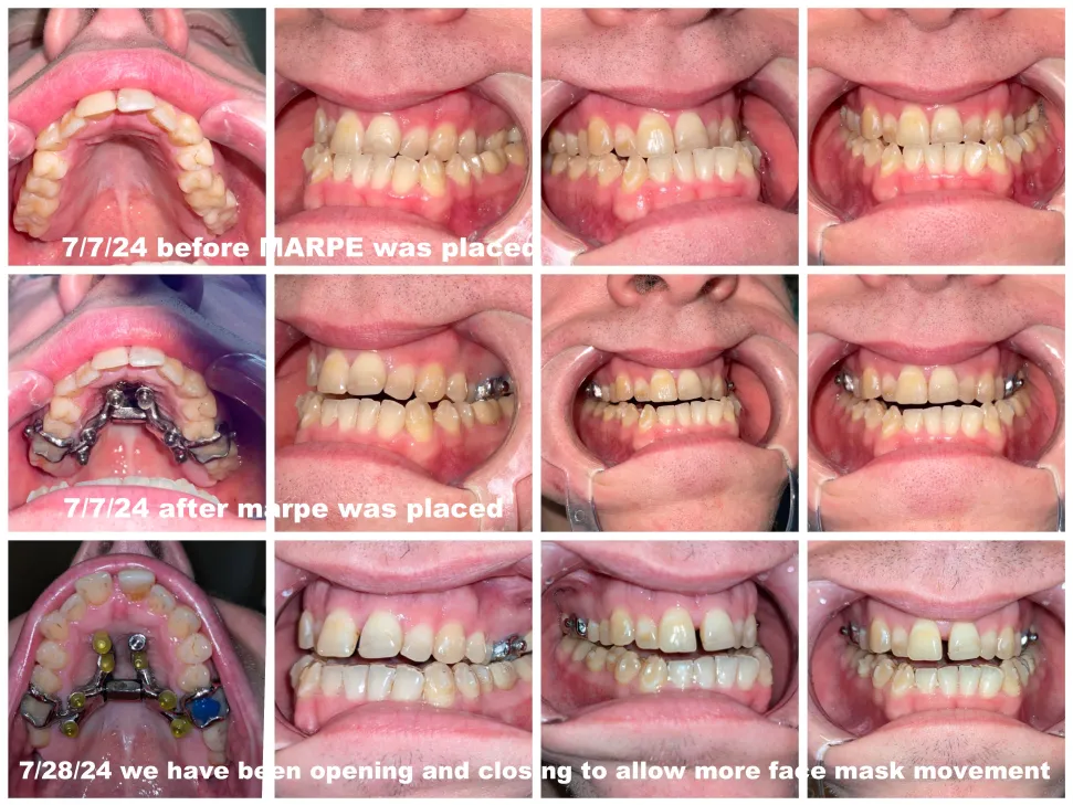 Image of multiple angles of a smile