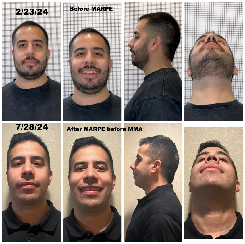 image of multiple views of patient smile